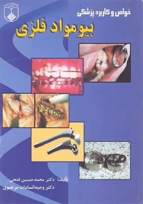 خواص و کاربرد پزشکی بیو مواد فلزی