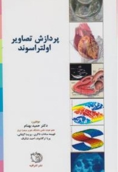 پردازش تصاویر اولتراسوند