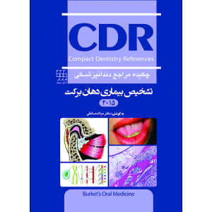 تشخیص بیماری دهان برکت 2015