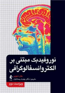 نوروفیدیک مبتنی بر الکتروانسفالوگرافی